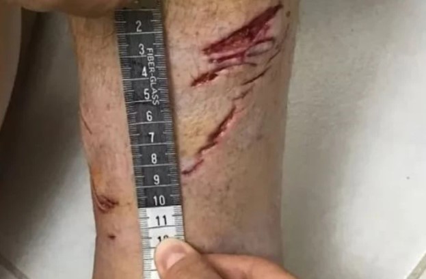 El feroz ataque de un tiburón a un turista en una playa paradisíaca de Brasil