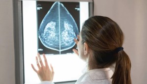 La Inteligencia Artificial podría ayudar detectar el cáncer de mama