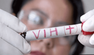 Un paciente en Alemania, el tercero del mundo que se cura del VIH tras un trasplante de células madre
