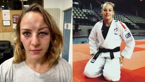 El crudo relato de una judoca tras el ataque de su pareja que conmociona a Francia: “Pensé que me iba a morir”