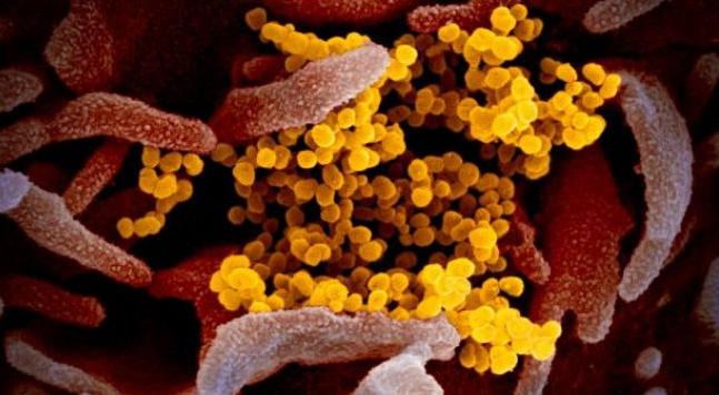 El coronavirus ataca a “muchos más órganos de los que se pensaba”: estas son sus secuelas en el cuerpo humano