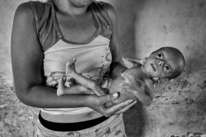 El régimen de Maduro busca ocultar la desnutrición infantil, advierte sacerdote