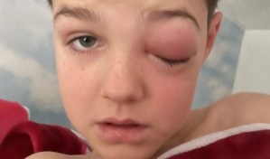“Ojo Covid”: niño casi pierde la visión tras contagiarse de coronavirus en Gran Bretaña