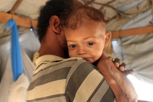 Tiene tres años y pesa tan solo cuatro kilos: La niña que está a punto de morir de desnutrición en Yemen (Fotos)