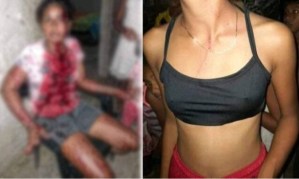 Profesora agredió brutalmente a una alumna y a su madre por celos en Colombia (FOTO)