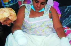 Terror en Honduras: Su enamorado la secuestró y le cortó las manos con un machete por rechazarlo