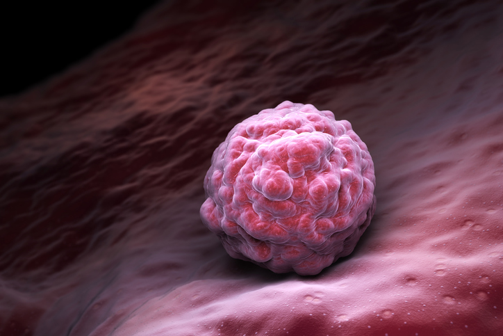El estudio que predice el riesgo de una enfermedad común en un embrión fecundado