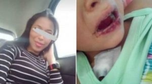 Consternación en Trujillo: Enfermera del Ivss intentó asesinar a su hijastra con un refresco con ácido