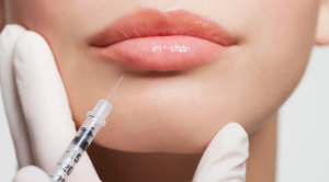 El ABC de los rellenos de labios: todo lo que hay que saber sobre uno de los tratamientos más demandados