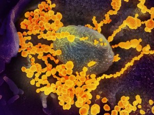 Así es el paso a paso del contagio del coronavirus, según un nuevo estudio