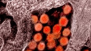 Hallan restos de coronavirus en heces humanas hasta seis meses después de la infección