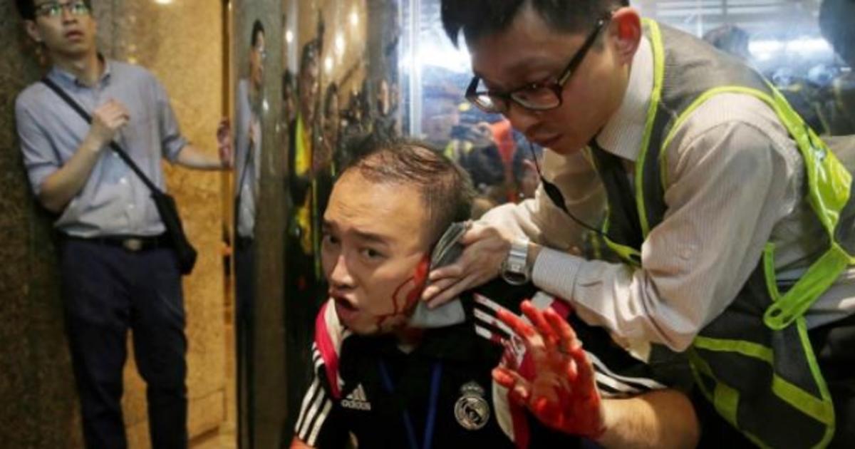 Condenan a 15 años de cárcel en Hong Kong a un hombre por morderle la oreja a otro sujeto