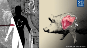 El hombre que recibió un trasplante de corazón de cerdo podría haber muerto víctima de un virus porcino