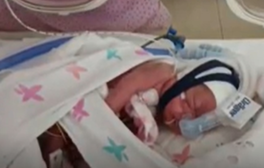 Un bebé de 400 gramos sobrevive gracias a que los médicos lo envolvieron en una bolsa de plástico