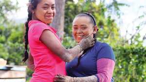 La desgarradora historia de las dos “mujeres árbol” en Colombia