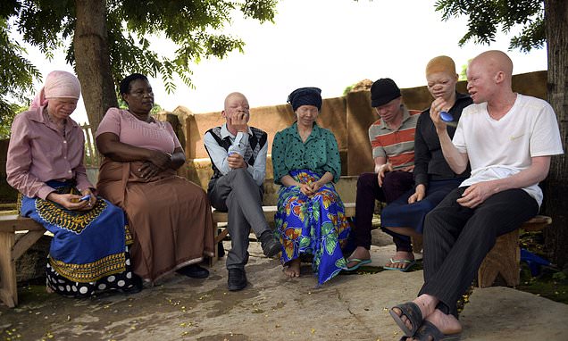 Sacerdote descuartizó a un albino en Malawi y vendió partes de su cuerpo para brujería