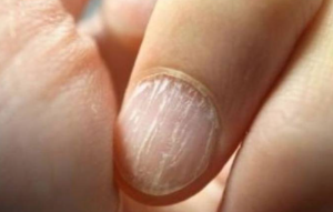 El terrible hábito que debes evitar para no arruinar tus uñas