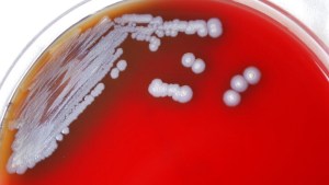 Bacteria peligrosa es encontrada por primera vez en EEUU: Estos son los síntomas y riesgos