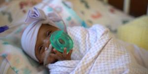 La bebé más pequeña del mundo que logró sobrevivir: “Pesa igual que una manzana” (VIDEO)
