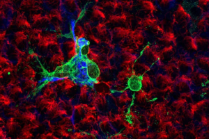 Estudio revela cómo el Covid-19 infecta a las células claves del cerebro