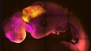 “Increíble que llegáramos tan lejos”: Crean en EEUU embriones sintéticos que desarrollaron cerebro y corazón