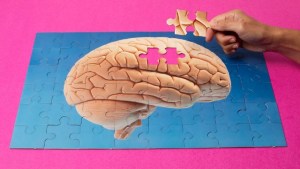¿Cuándo empieza el Alzheimer? Dos estudios internacionales dan nuevas pistas