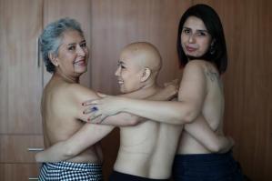 Cáncer de mama en tres generaciones, mucho más que un lazo rosa (Fotos)