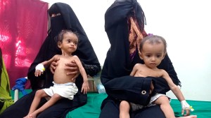 Las IMPACTANTES IMÁGENES de los niños yemeníes que se mueren de hambre en medio de la guerra sin fin