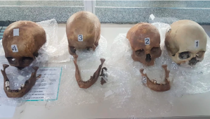 Macabro hallazgo en Argentina: venezolana llevaba cuatro cráneos humanos en una maleta