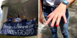 Legítima AN repudió el brutal ataque chavista contra estudiantes de la ULA