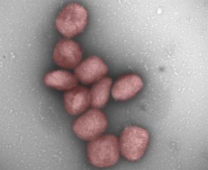 El virus de la viruela del mono podría transmitirse también por vía aérea