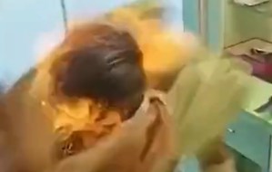 Intentó hacerle un corte de cabello con fuego a un amigo y lo dejó con graves quemaduras (VIDEO)