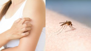 “Picadas y zumbidos de insectos”: los mejores trucos caseros fáciles y efectivos para espantar zancudos y mosquitos