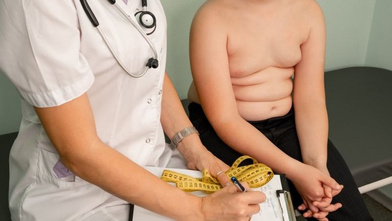 Las polémicas nuevas recomendaciones de los pediatras en EEUU para tratar la obesidad infantil