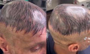 No lo hagan en casa: se tatuó “cabello” en su cabeza rapada para ocultar su calvicie (VIDEO)