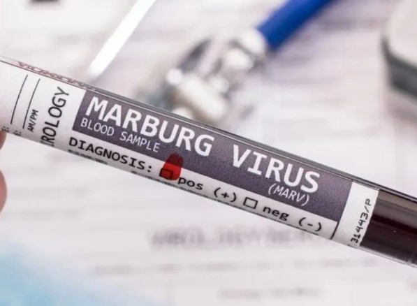 Dos nuevas muertes por fiebre del virus Marburgo en Guinea Ecuatorial