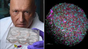 Una universidad en EEUU presentan un plan para desarrollar “biocomputadoras” que funcionan con células cerebrales humanas