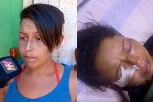 Locura en Argentina: fingió su muerte para que su vecina dejara de atacarla a golpes y cuchillazos