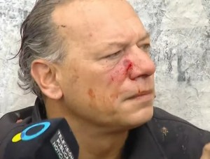 EN VIDEO: le rompieron la cara al ministro kirchnerista de Seguridad durante una protesta en Buenos Aires