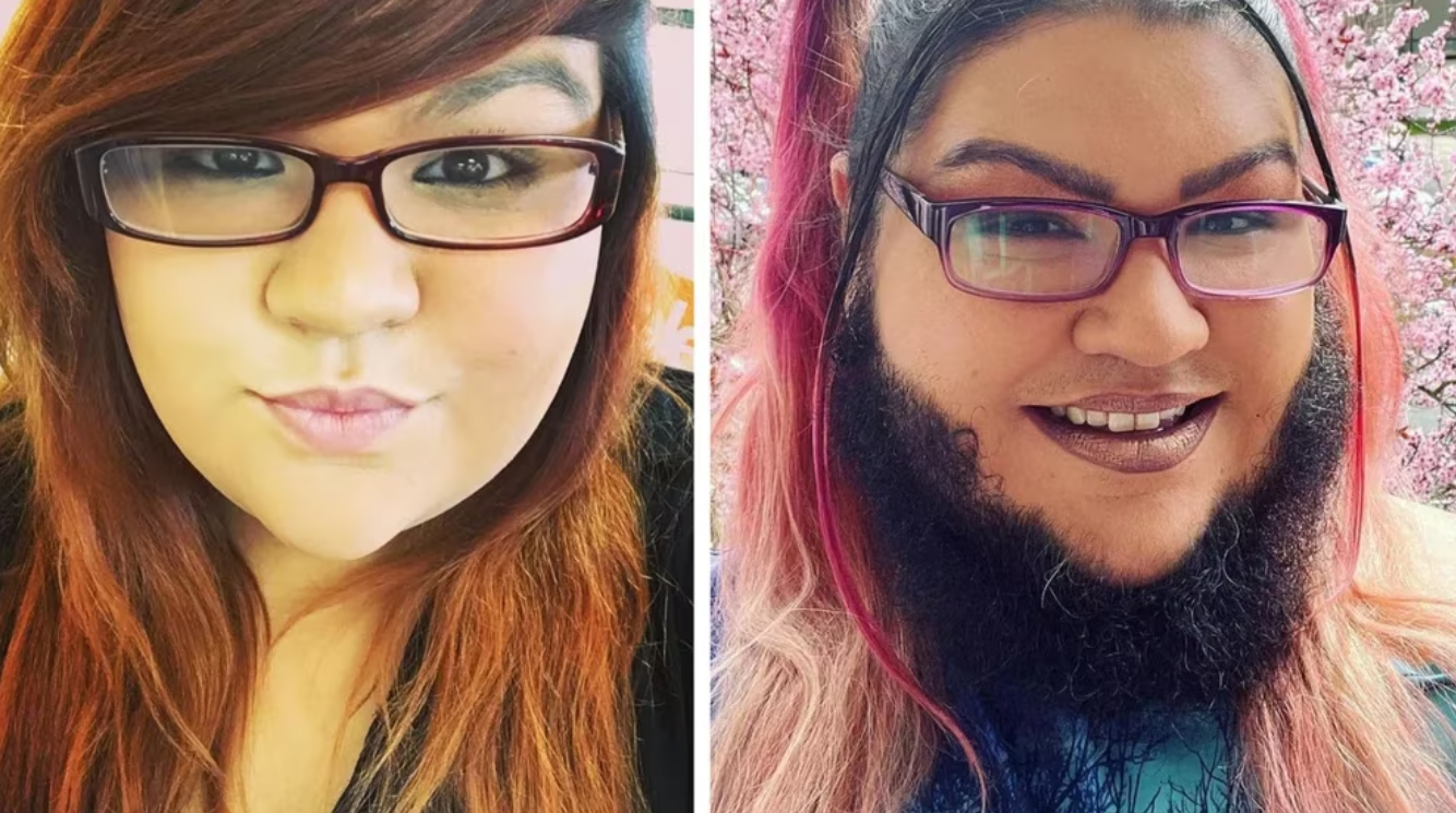 Una mujer cansada de depilarse decidió dejar crecer su barba: “Me siento realmente hermosa” (Fotos)