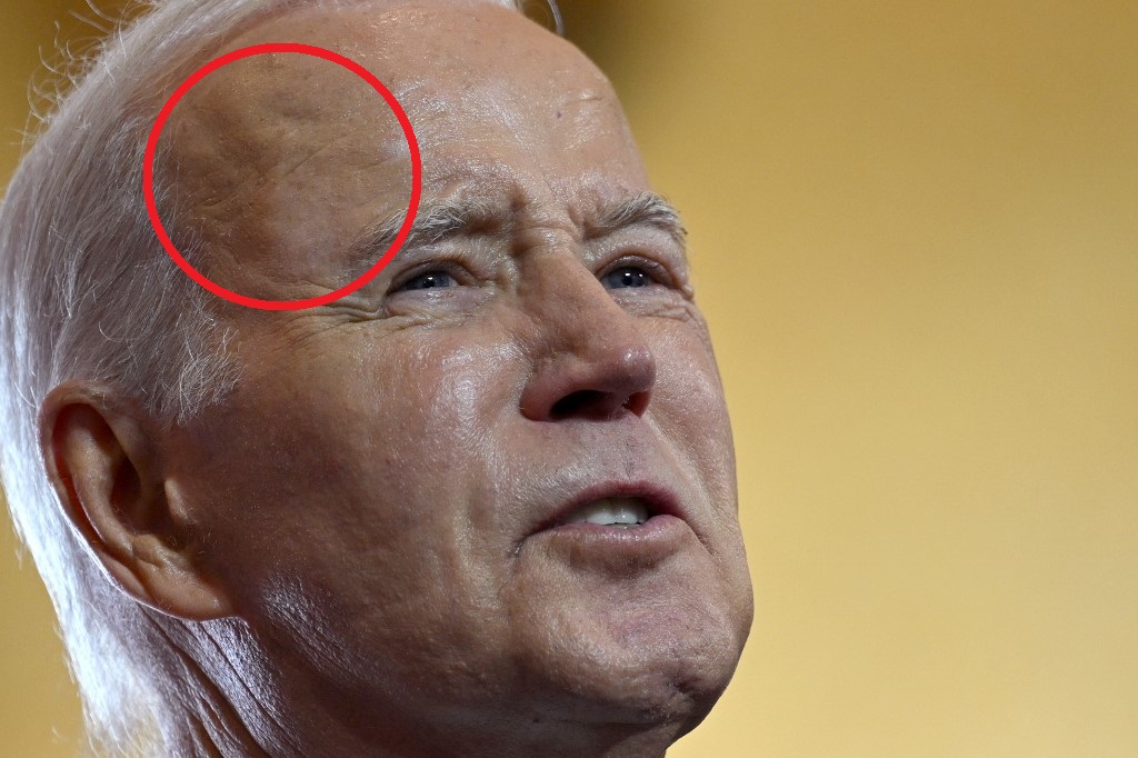 Marcas en la cara de Biden causaron preocupación y la Casa Blanca tuvo que decir la verdad
