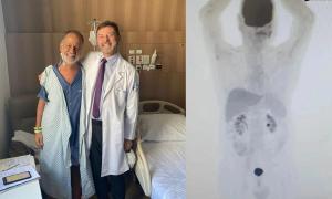 “Milagro de la ciencia”: paciente con cáncer curó sus tumores con innovador tratamiento