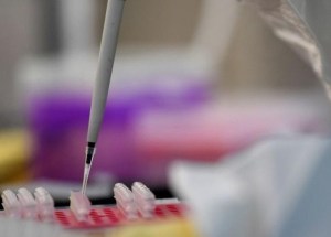 Científico hongkonés desarrolla un análisis de sangre para detectar células cancerígenas