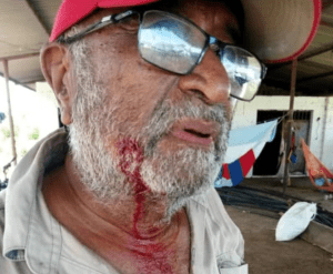 Armados con machetes y amenazas de muerte: invasores aterrorizan a campesinos en Guárico