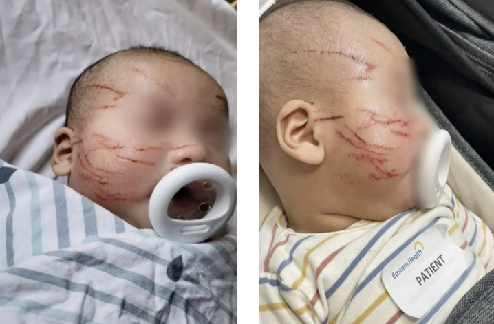 Madre desesperada arremete contra guardería luego que rasguñaran la cara de su bebé más de 20 veces (Imágenes sensibles)
