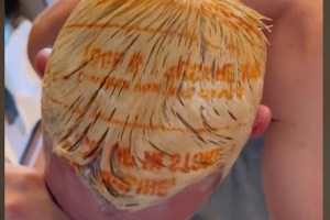 VIRAL: El terrible accidente de un estadounidense que intentó teñirse el cabello con bolsa de plástico (VIDEO)