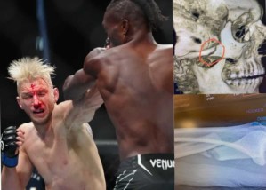 Un ruido escalofriante, un combate sangriento y dos fracturas en la “pelea del año” de la UFC (VIDEO)