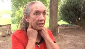 Anciana fue mordida una docena de veces por zorro que irrumpió en su casa en Carolina del Norte