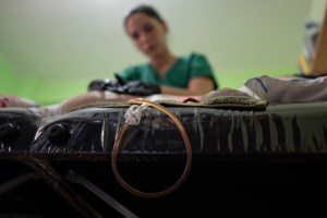 El calvario de los “biopolímeros” en tratamientos estéticos en Venezuela (Fotos)