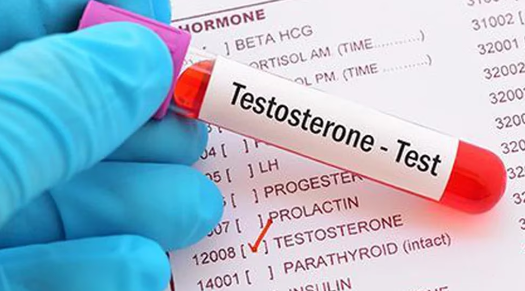 Cuáles son los factores que reducen la testosterona de los hombres a medida que envejecen